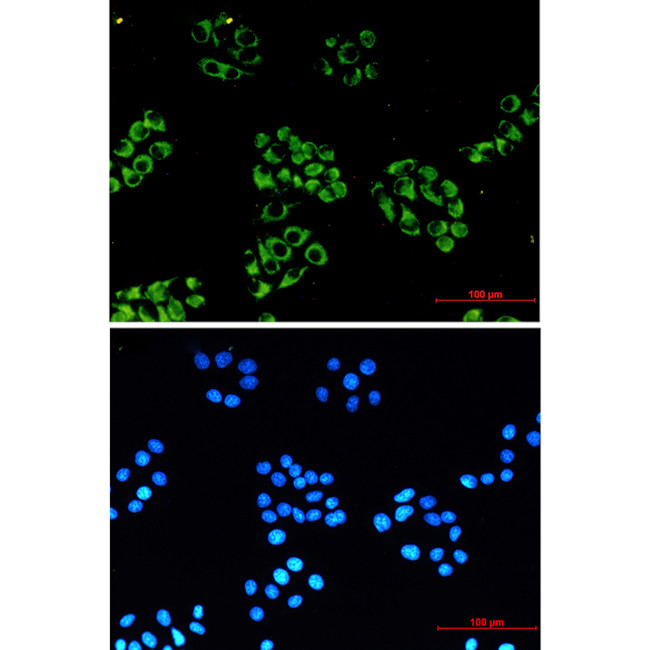 NDUFB10 Antibody in Immunocytochemistry (ICC/IF)