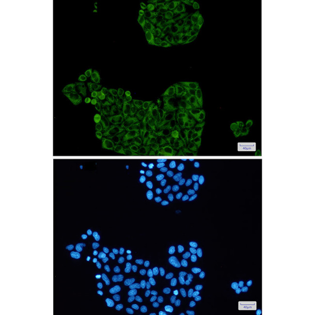 PFKP Antibody in Immunocytochemistry (ICC/IF)