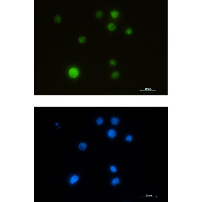 SMARCA5 Antibody in Immunocytochemistry (ICC/IF)