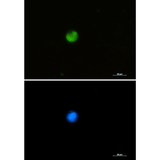 hnRNP M Antibody in Immunocytochemistry (ICC/IF)