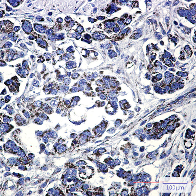 MUT Antibody in Immunohistochemistry (Paraffin) (IHC (P))