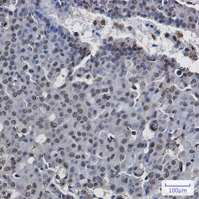 POLR2E Antibody in Immunohistochemistry (Paraffin) (IHC (P))