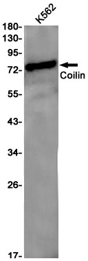 Coilin Antibody in Western Blot (WB)