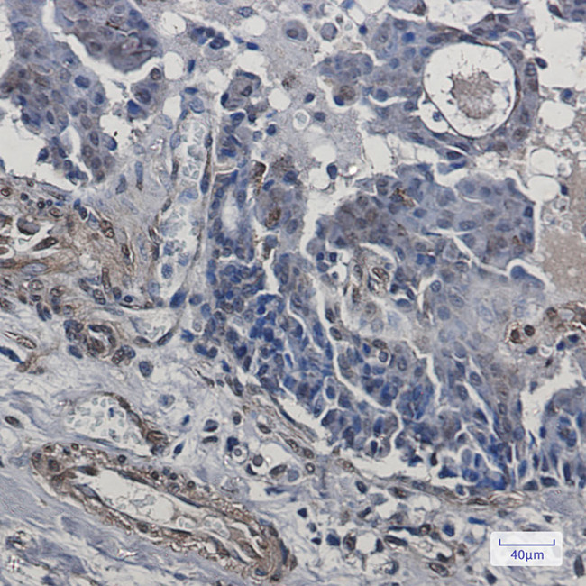 TRIP10 Antibody in Immunohistochemistry (Paraffin) (IHC (P))