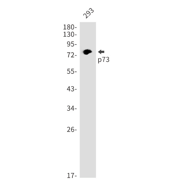 p73 Antibody in Western Blot (WB)