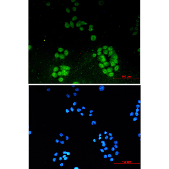 ENT2 Antibody in Immunocytochemistry (ICC/IF)