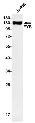 ADAP Antibody in Western Blot (WB)