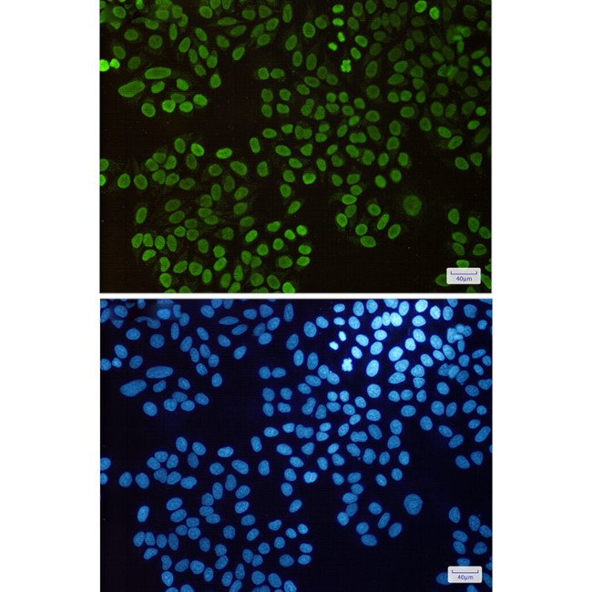 Histone H1.3 Antibody in Immunocytochemistry (ICC/IF)