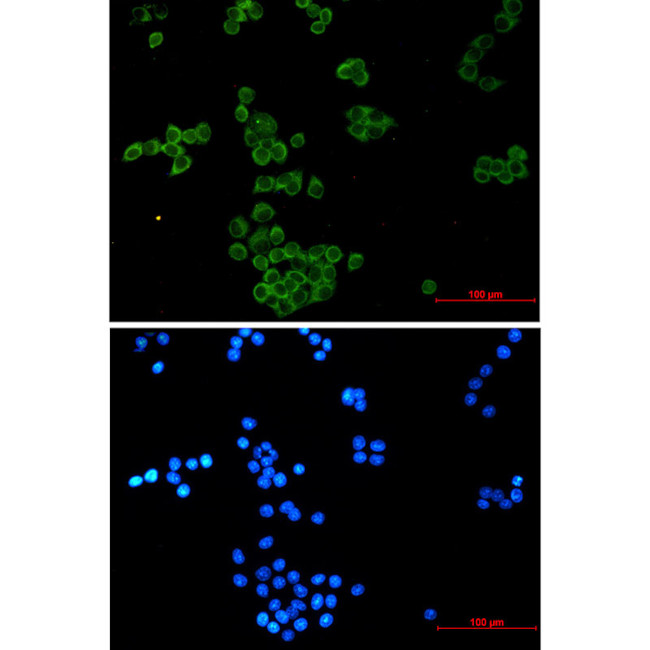 NCK1 Antibody in Immunocytochemistry (ICC/IF)