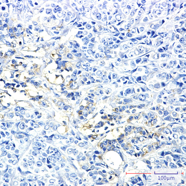HK2 Antibody in Immunohistochemistry (Paraffin) (IHC (P))