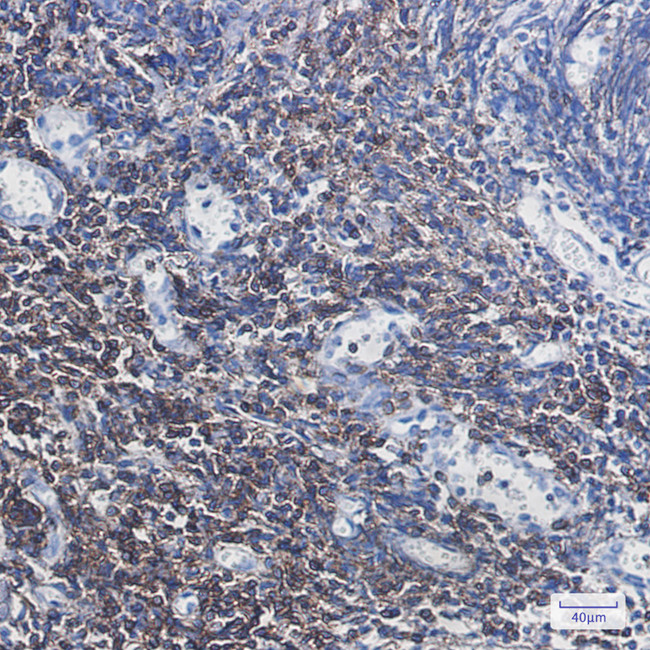 CD3g Antibody in Immunohistochemistry (Paraffin) (IHC (P))