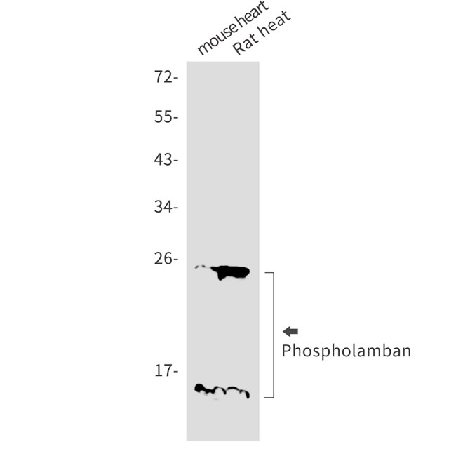 Phospholamban Antibody in Western Blot (WB)