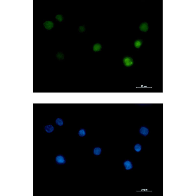 ANP32B Antibody in Immunocytochemistry (ICC/IF)