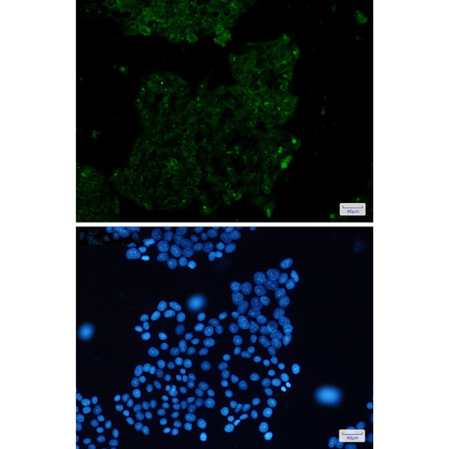 ACTA1 Antibody in Immunocytochemistry (ICC/IF)