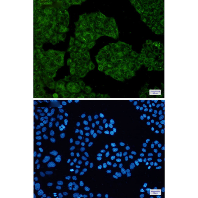 NUDT9 Antibody in Immunocytochemistry (ICC/IF)