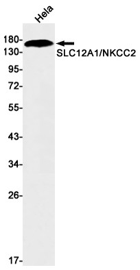 NKCC2 Antibody in Western Blot (WB)