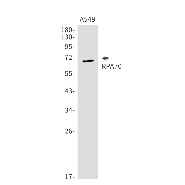RPA70 Antibody in Western Blot (WB)