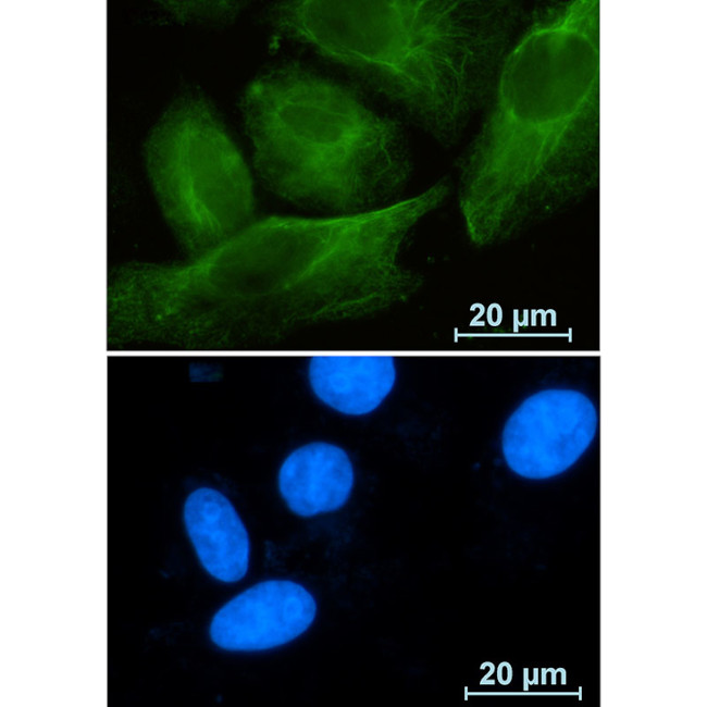 RAB10 Antibody in Immunocytochemistry (ICC/IF)