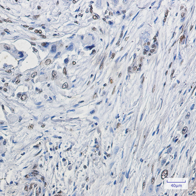 ELK1 Antibody in Immunohistochemistry (Paraffin) (IHC (P))