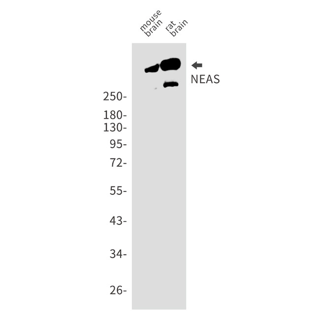 SPTAN1 Antibody in Western Blot (WB)