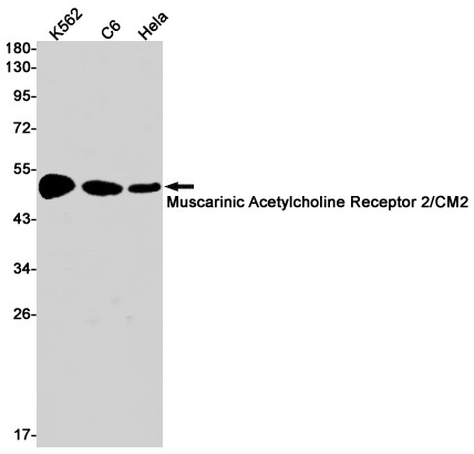 CHRM2 Antibody in Western Blot (WB)