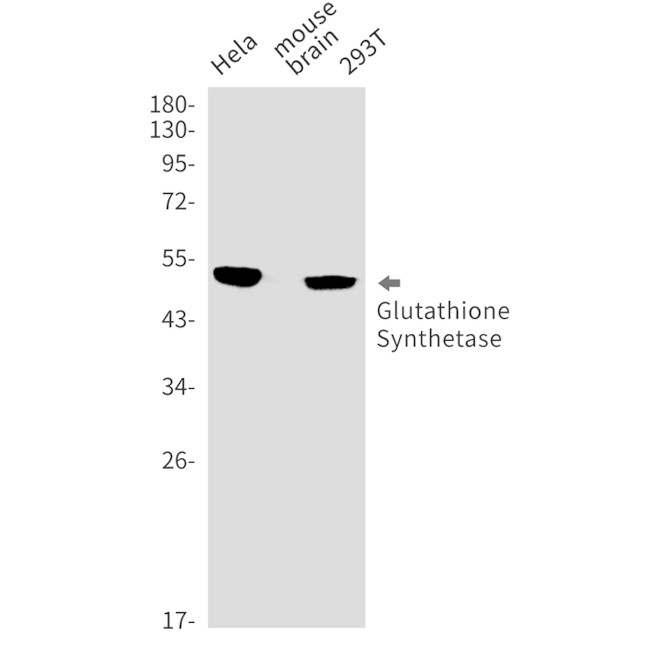 GSS Antibody in Western Blot (WB)