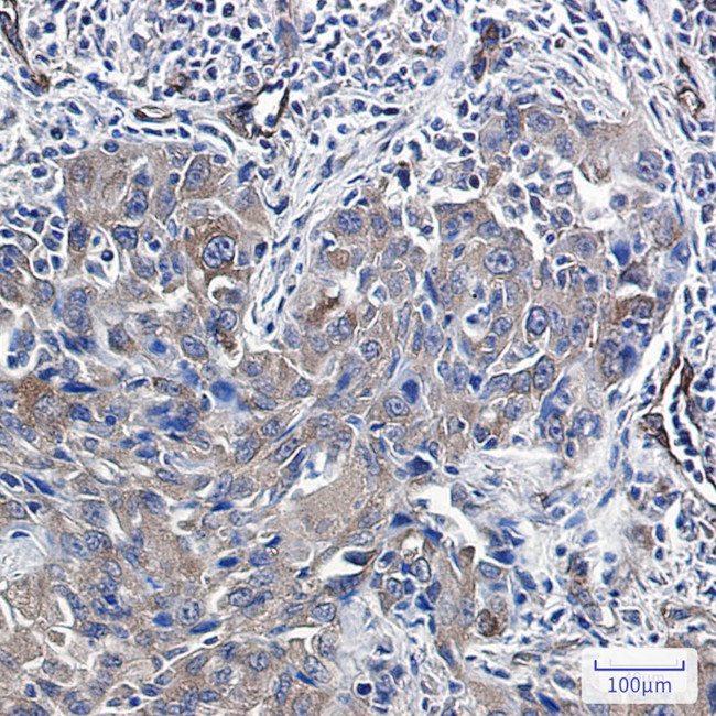 Radixin Antibody in Immunohistochemistry (Paraffin) (IHC (P))