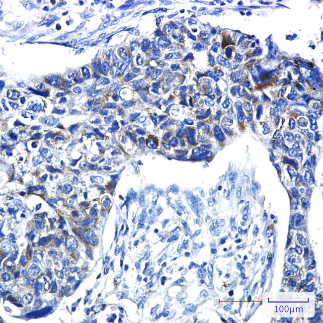 PRC1 Antibody in Immunohistochemistry (Paraffin) (IHC (P))