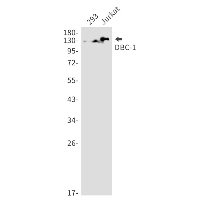 DBC1 Antibody in Western Blot (WB)