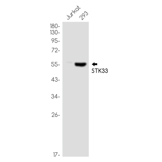 STK33 Antibody in Western Blot (WB)