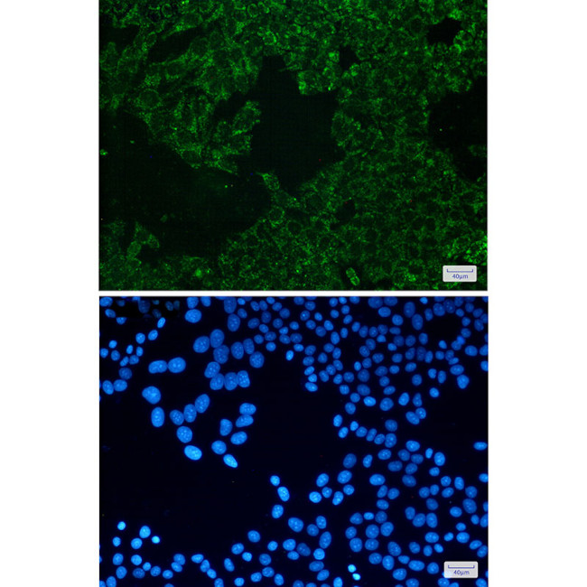 SEC61alpha Antibody in Immunocytochemistry (ICC/IF)