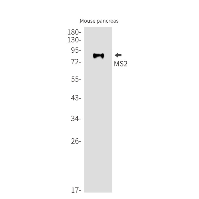 ADAM8 Antibody in Western Blot (WB)