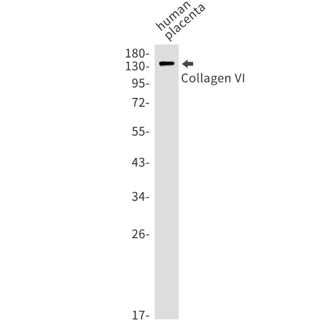 COL6A1 Antibody in Western Blot (WB)