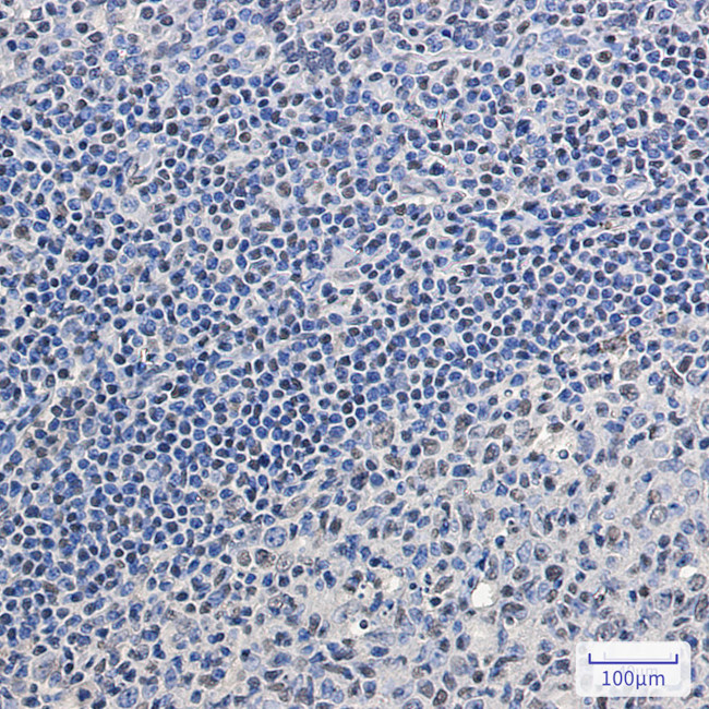 SRSF2 Antibody in Immunohistochemistry (Paraffin) (IHC (P))