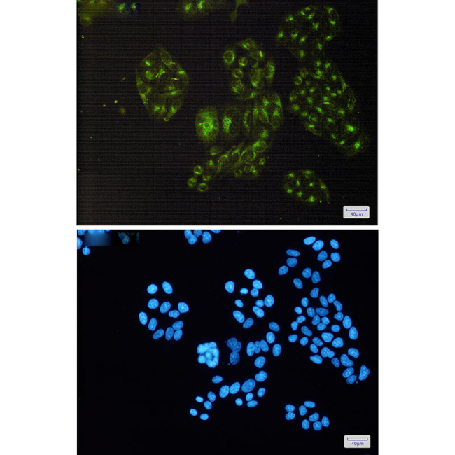 PDLIM1 Antibody in Immunocytochemistry (ICC/IF)