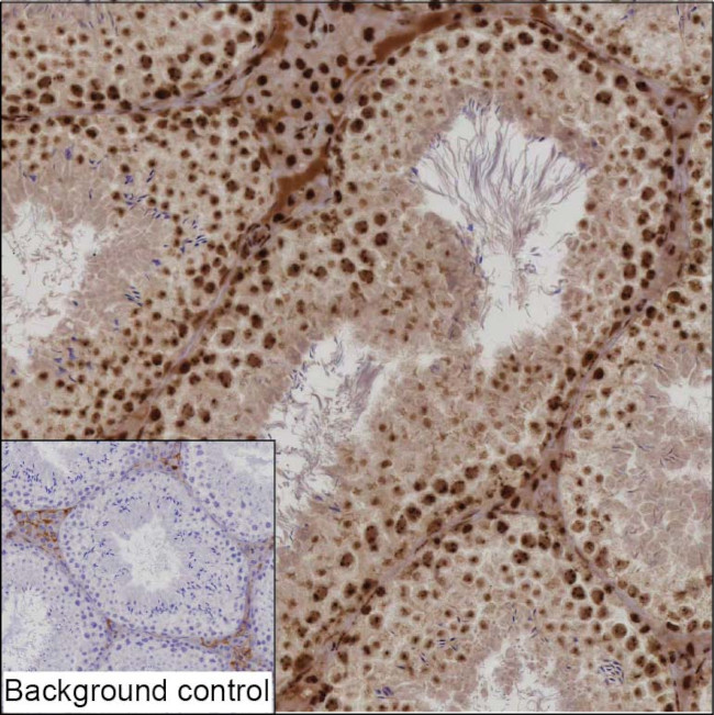 NPM1 Antibody in Immunohistochemistry (Paraffin) (IHC (P))
