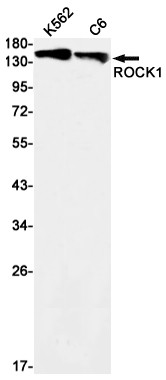 ROCK1 Antibody in Western Blot (WB)