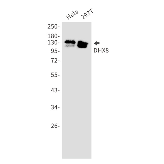 DHX8 Antibody in Western Blot (WB)