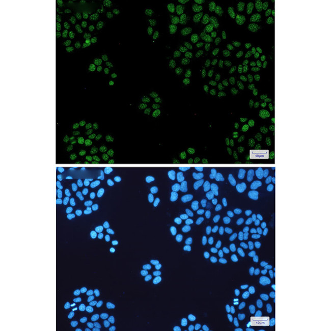 HP1 alpha Antibody in Immunocytochemistry (ICC/IF)