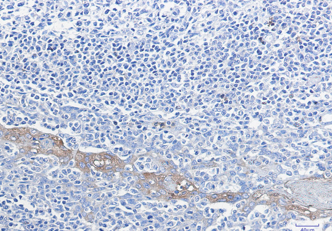 G6PD Antibody in Immunohistochemistry (Paraffin) (IHC (P))