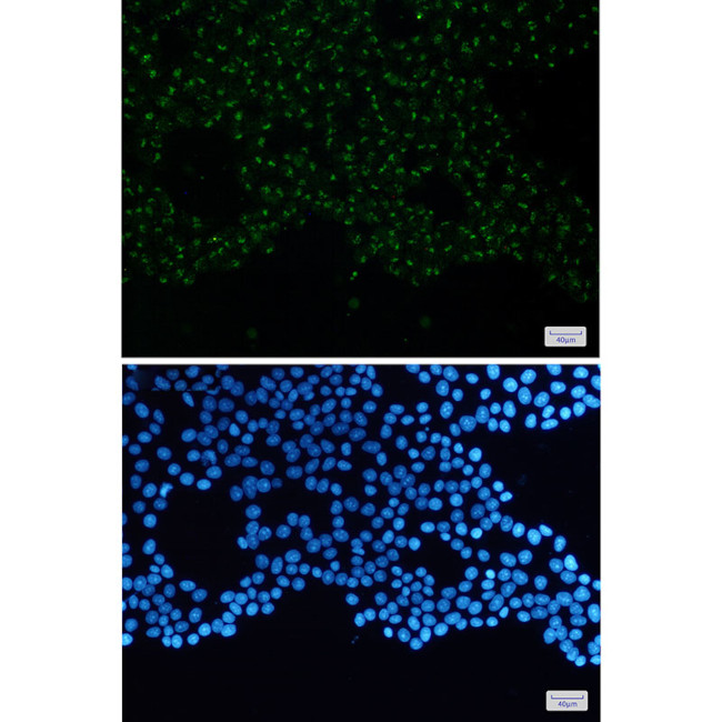 N-WASP Antibody in Immunocytochemistry (ICC/IF)