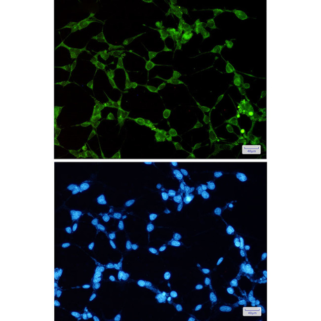 ORP1 Antibody in Immunocytochemistry (ICC/IF)