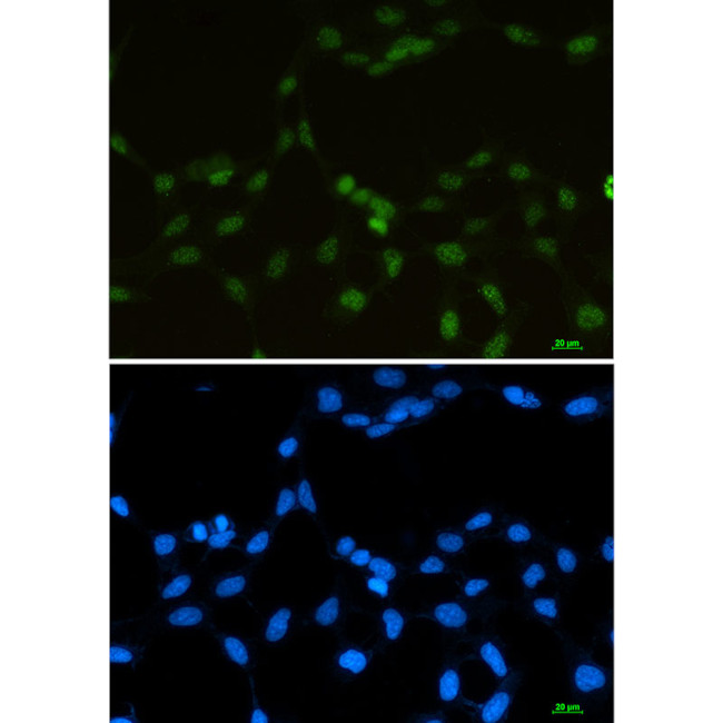 RBMX Antibody in Immunocytochemistry (ICC/IF)