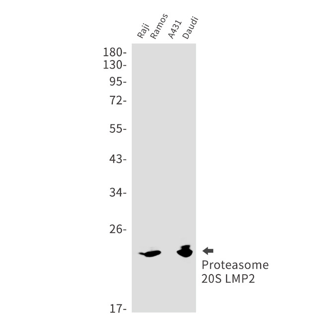 PSMB9 Antibody in Western Blot (WB)