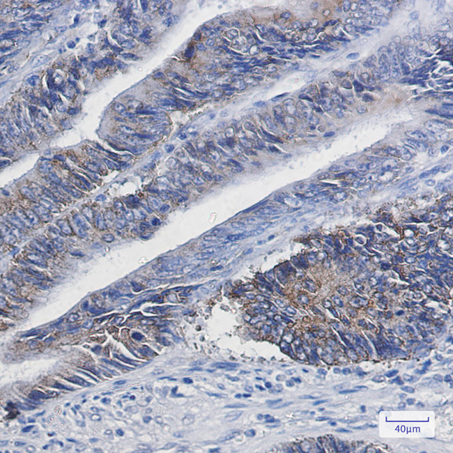 DGAT1 Antibody in Immunohistochemistry (Paraffin) (IHC (P))