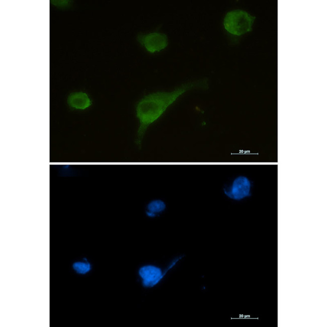 Syntrophin alpha-1 Antibody in Immunocytochemistry (ICC/IF)