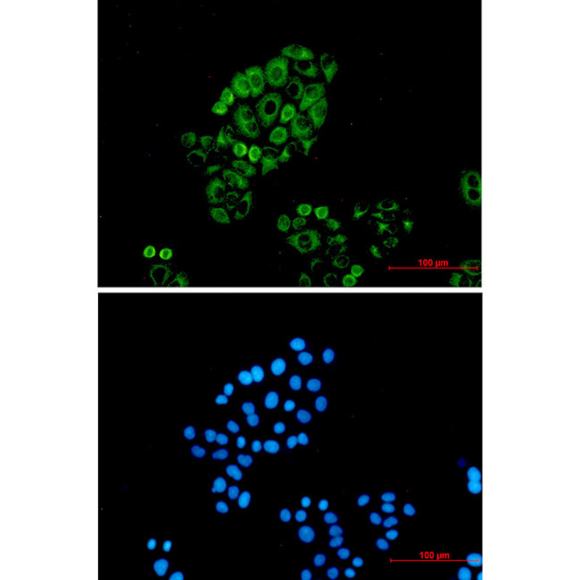 Cytokeratin 18 Antibody in Immunocytochemistry (ICC/IF)