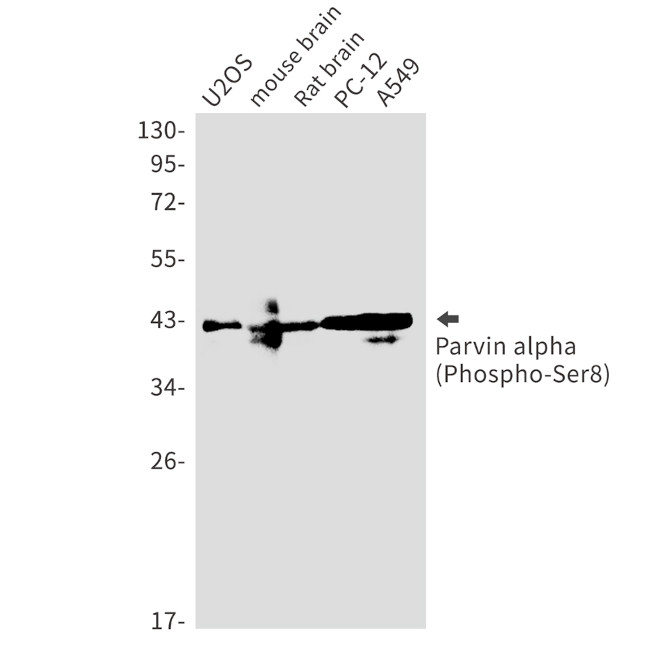 Phospho-PARVA (Ser8) Antibody in Western Blot (WB)