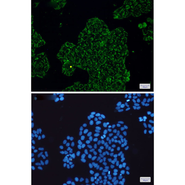 CLIC4 Antibody in Immunocytochemistry (ICC/IF)