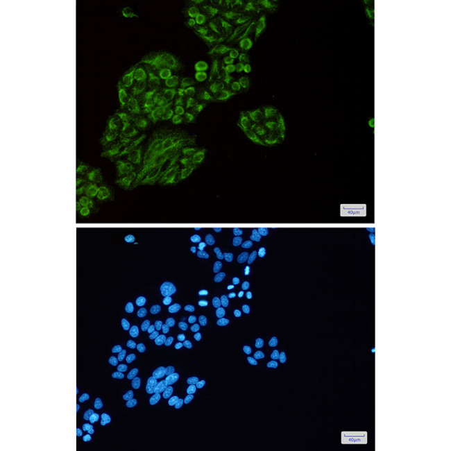TEC Antibody in Immunocytochemistry (ICC/IF)
